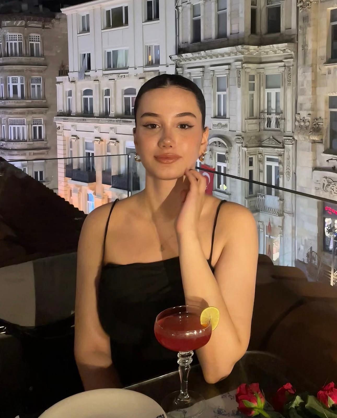 Cansu – Primary Rhinoplasty