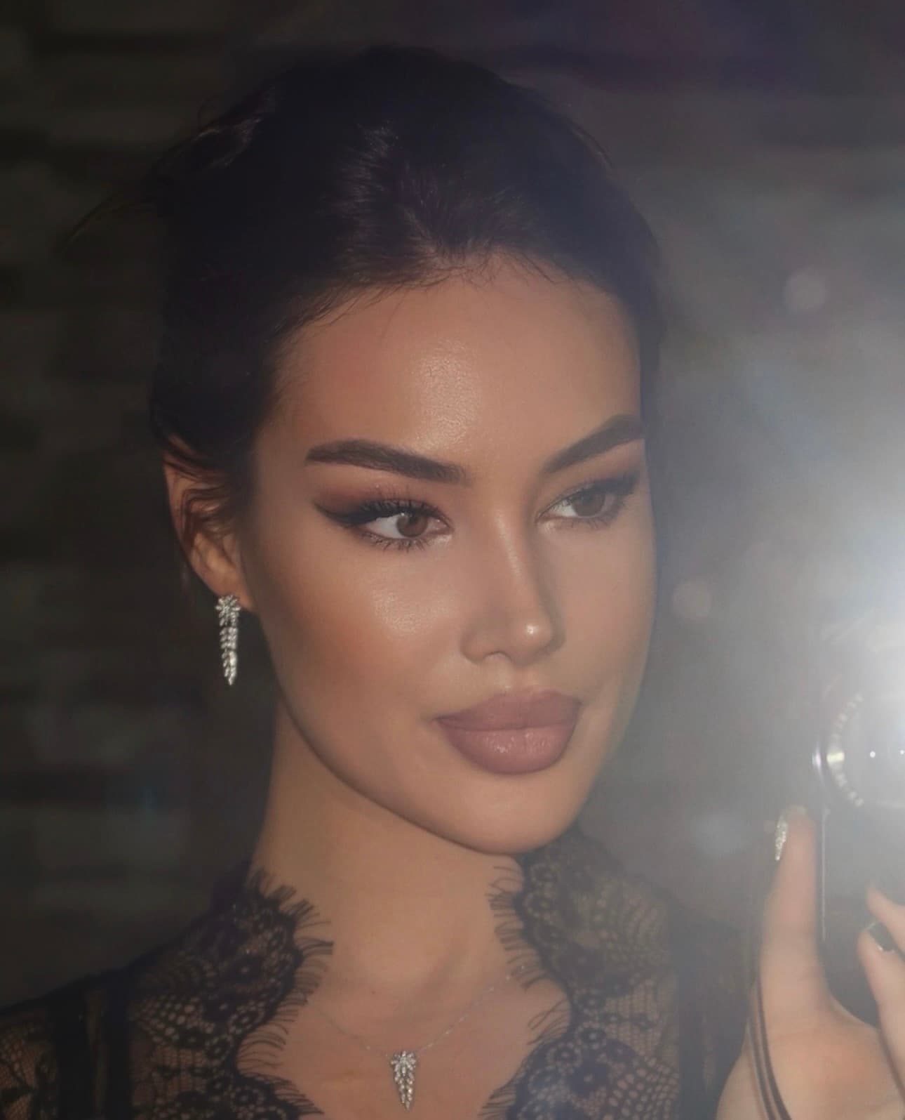 Lorena – Primary Rhinoplasty